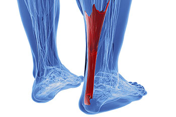 Achilles tendon treatment in the Middle (Central) Tennessee: Nashville, TN 37211, Smyrna, TN 37167, Spring Hill, TN 37174, Columbia, TN 38401, Dickson, TN 37055, Fairview, TN 37062 and Hohenwald, TN 38462 areas