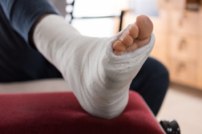 The Role of a Podiatrist in Broken Ankle Recovery